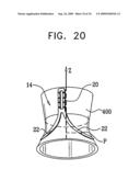 VALVE SUTURING AND IMPLANTATION PROCEDURES diagram and image