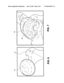 Methods, Devices and Compositions for Adhering Hydrated Polymer Implants to Bone diagram and image