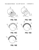 Methods, Devices and Compositions for Adhering Hydrated Polymer Implants to Bone diagram and image