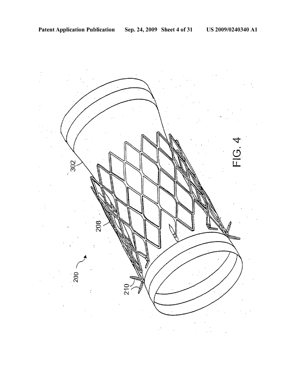 Bariatric sleeve - diagram, schematic, and image 05