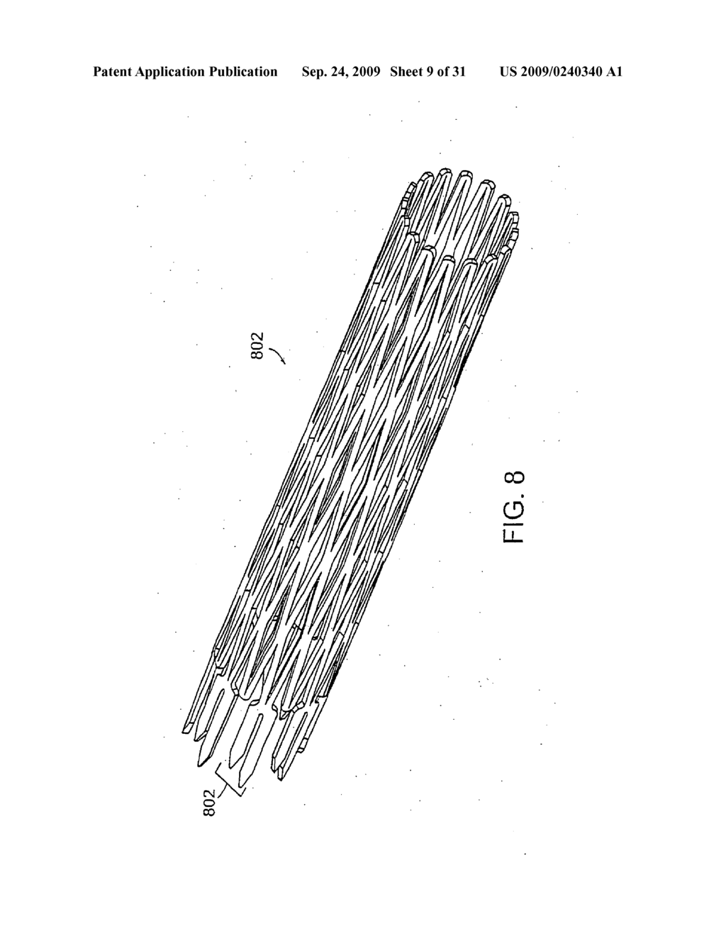 Bariatric sleeve - diagram, schematic, and image 10