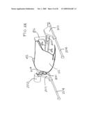 BAGGING ASSEMBLY diagram and image