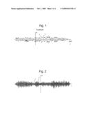 SOUND-OBJECT ORIENTED ANALYSIS AND NOTE-OBJECT ORIENTED PROCESSING OF POLYPHONIC SOUND RECORDINGS diagram and image