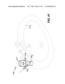 Draining holder diagram and image