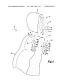 ADJUSTABLE HEAD RESTRAINT SYSTEM FOR AN AUTOMOTIVE VEHICLE SEAT diagram and image