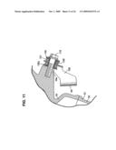 Motorcycle including brake-by-wire system with flexibly supported fluid pressure regulating unit diagram and image