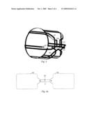  VOLUME COIL FOR MRI SYSTEM diagram and image