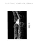 OPTICAL COHERENCE TOMOGRAPHY DEVICE, METHOD, AND SYSTEM diagram and image