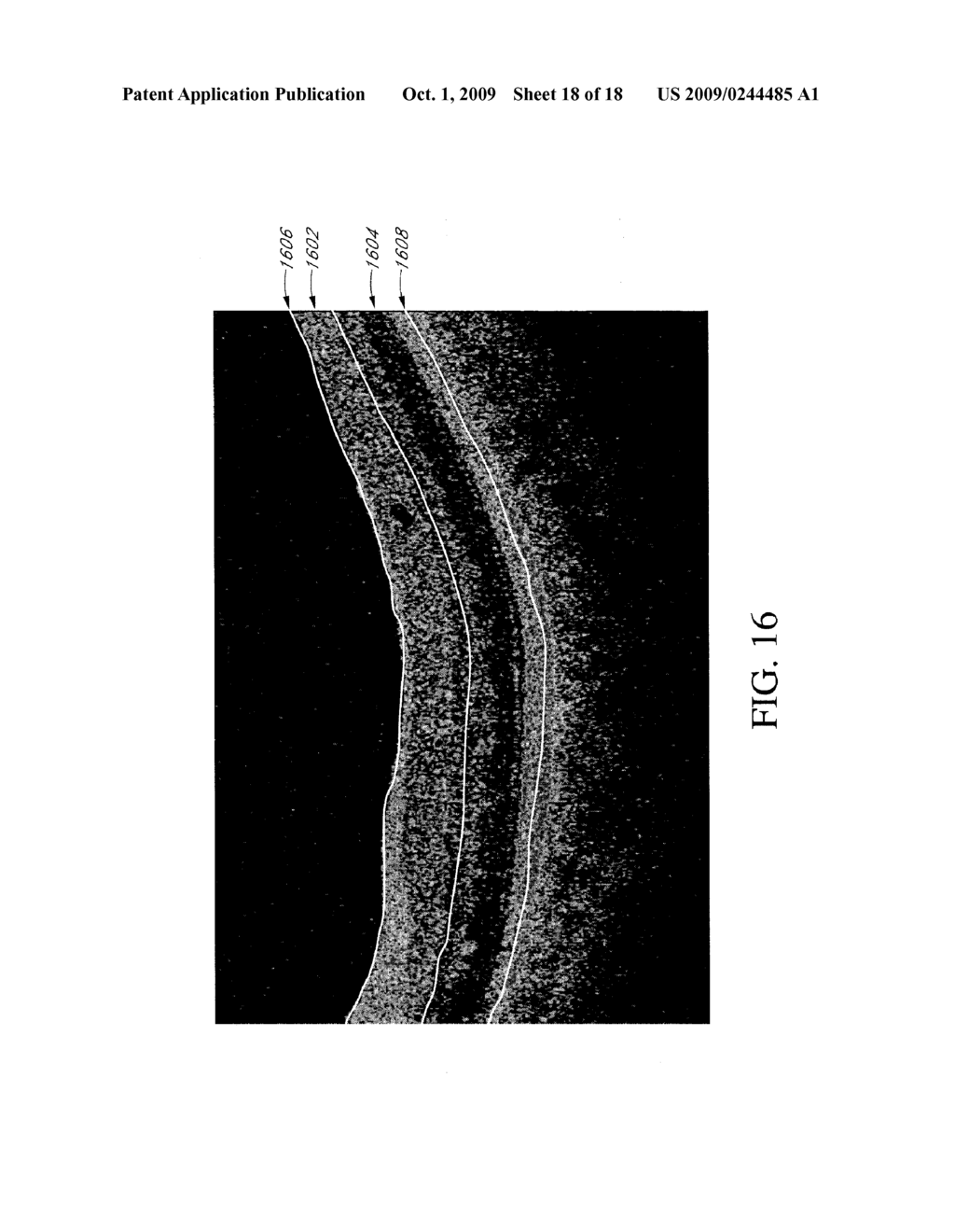 OPTICAL COHERENCE TOMOGRAPHY DEVICE, METHOD, AND SYSTEM - diagram, schematic, and image 19