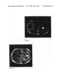 MAGNETIC RESONANCE CONTRAST MEDIA diagram and image