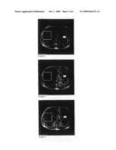 MAGNETIC RESONANCE CONTRAST MEDIA diagram and image