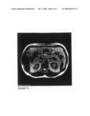 MAGNETIC RESONANCE CONTRAST MEDIA diagram and image