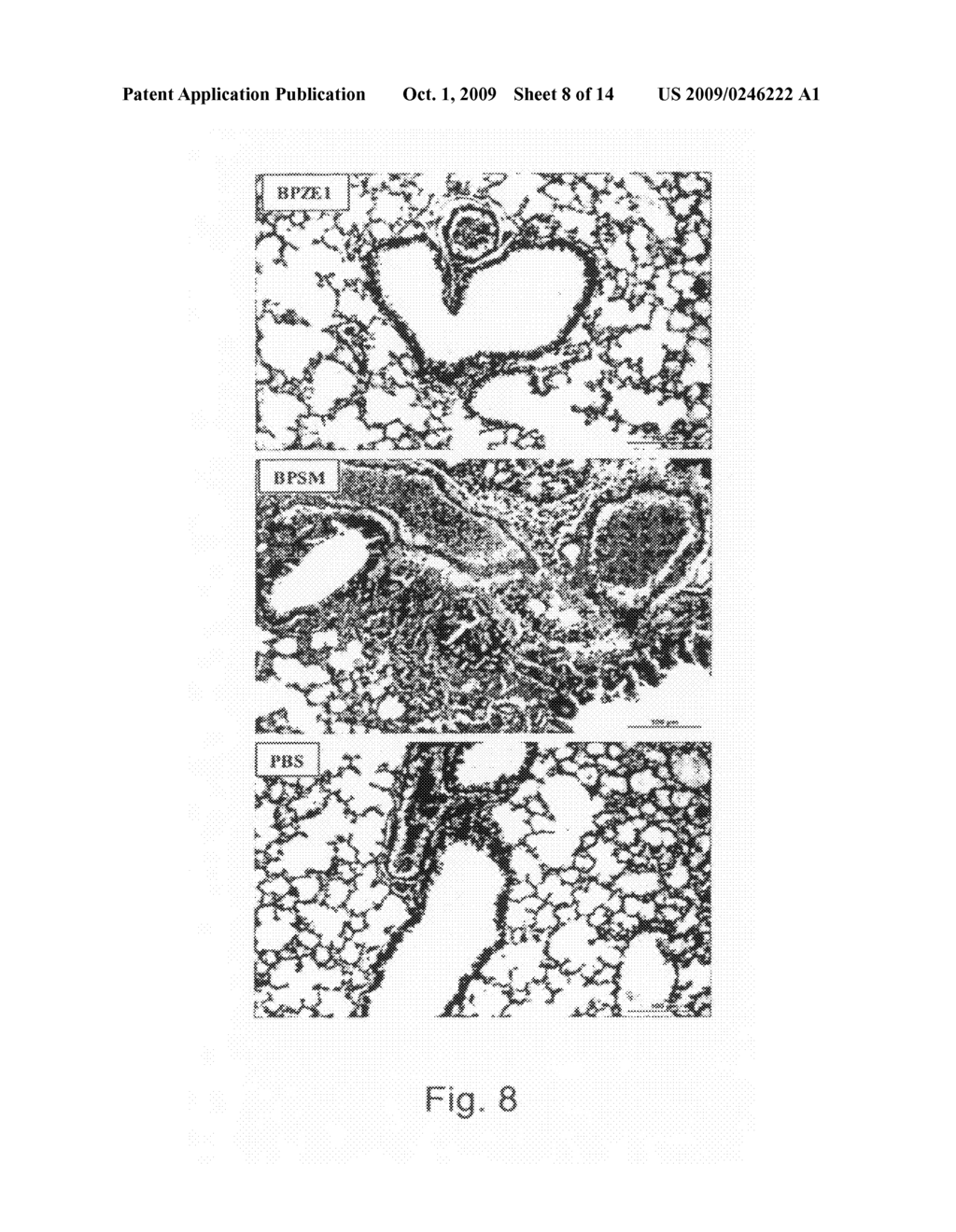 Live Attenuated Bordetella Strains as a Single Dose Vaccine Against Whooping cough - diagram, schematic, and image 09