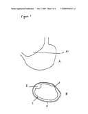 SIMULATOR FOR MAJOR SURGICAL OPERATIONS diagram and image