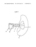 SIMULATOR FOR MAJOR SURGICAL OPERATIONS diagram and image