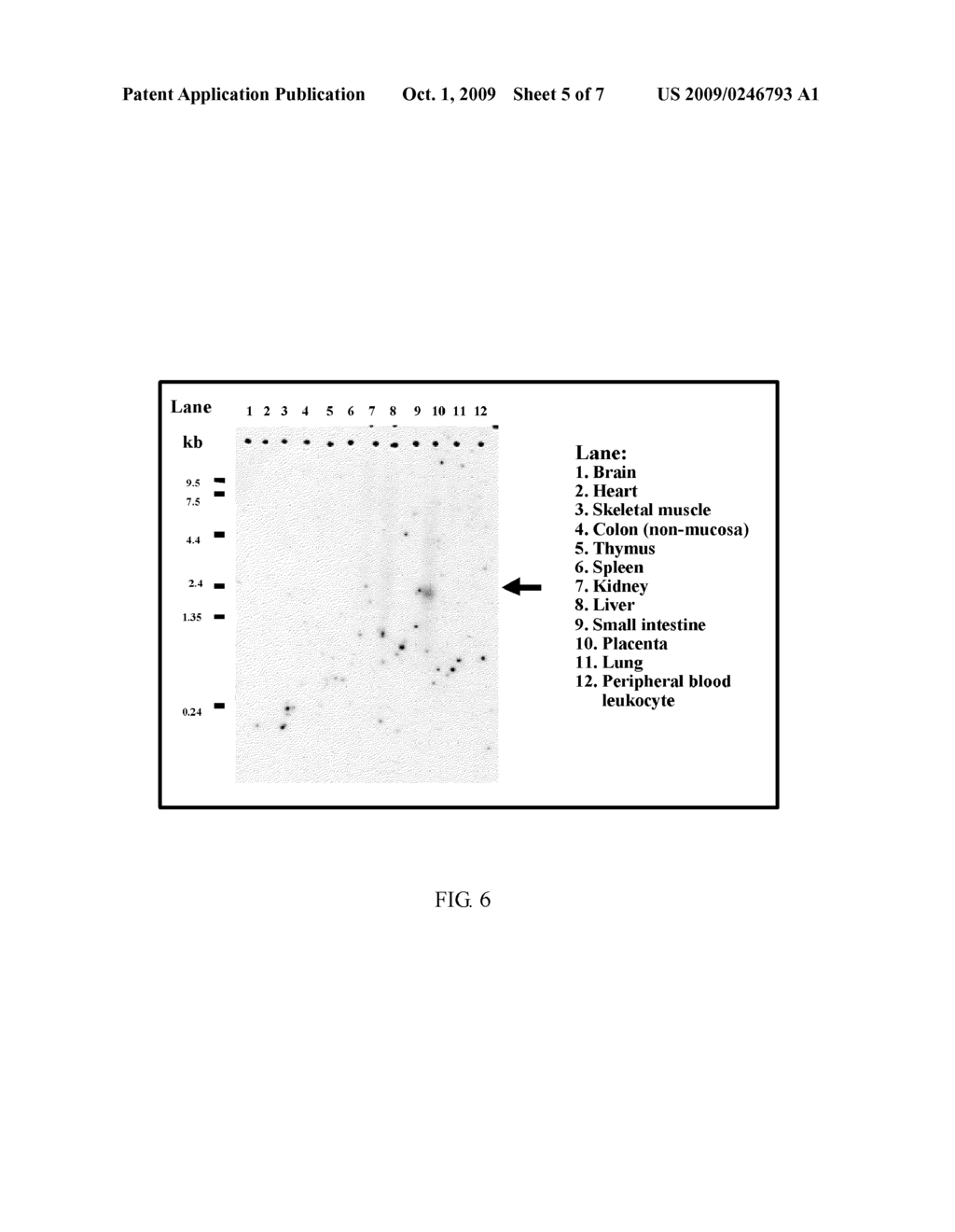 CUDR AS BIOMARKER FOR CANCER PROGRESSION AND THERAPEUTIC RESPONSE - diagram, schematic, and image 06