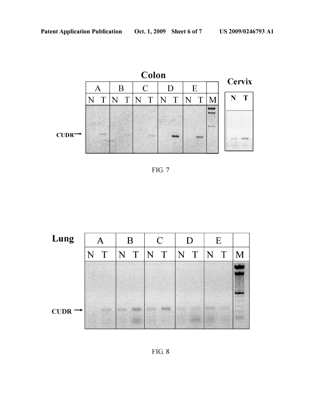 CUDR AS BIOMARKER FOR CANCER PROGRESSION AND THERAPEUTIC RESPONSE - diagram, schematic, and image 07