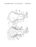 LACROSSE HEAD diagram and image