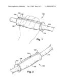 Endoscope Gripping Device diagram and image