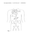 CEREBRAL PERFUSION AUGMENTATION diagram and image