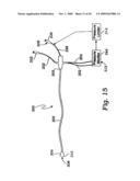 CEREBRAL PERFUSION AUGMENTATION diagram and image