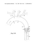 CEREBRAL PERFUSION AUGMENTATION diagram and image