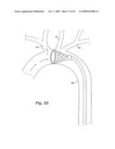 CEREBRAL PERFUSION AUGMENTATION diagram and image