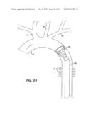 CEREBRAL PERFUSION AUGMENTATION diagram and image