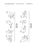 Foot/ankle wrap and method of treating infirmities and abnormalities of the foot and ankle diagram and image