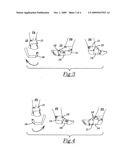 Foot/ankle wrap and method of treating infirmities and abnormalities of the foot and ankle diagram and image