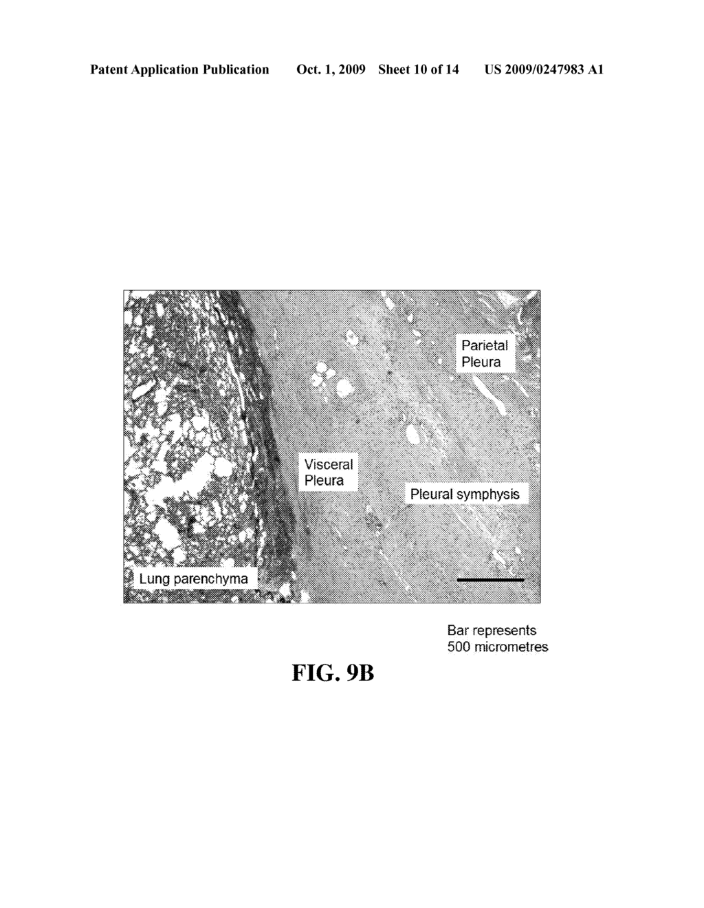 Method and System for Sustained-Release of Sclerosing Agent - diagram, schematic, and image 11