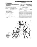 Electrostatic vascular filters diagram and image