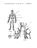 Electrostatic vascular filters diagram and image