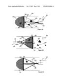 Electrostatic vascular filters diagram and image