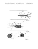 Electrostatic vascular filters diagram and image