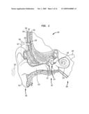 TISSUE INJECTION FIXATION SYSTEM FOR A PROSTHETIC DEVICE diagram and image