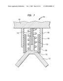 TISSUE INJECTION FIXATION SYSTEM FOR A PROSTHETIC DEVICE diagram and image