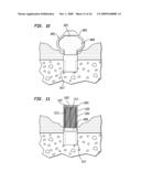 TISSUE INJECTION FIXATION SYSTEM FOR A PROSTHETIC DEVICE diagram and image