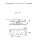 TISSUE INJECTION FIXATION SYSTEM FOR A PROSTHETIC DEVICE diagram and image