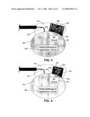 Wireless Implantable Medical Device diagram and image