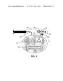 Wireless Implantable Medical Device diagram and image