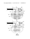 Wireless Implantable Medical Device diagram and image