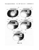 Wireless Implantable Medical Device diagram and image