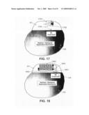 Wireless Implantable Medical Device diagram and image