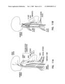 METHOD AND APPARATUS FOR CONTROLLING AUTONOMIC BALANCE USING NEURAL STIMULATION diagram and image