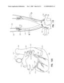 METHOD AND APPARATUS FOR CONTROLLING AUTONOMIC BALANCE USING NEURAL STIMULATION diagram and image