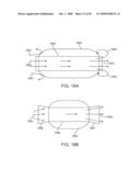 Double-Walled Stent System diagram and image