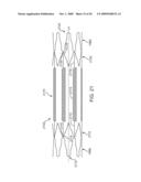 Double-Walled Stent System diagram and image