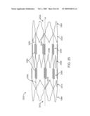 Double-Walled Stent System diagram and image