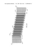 Double-Walled Stent System diagram and image